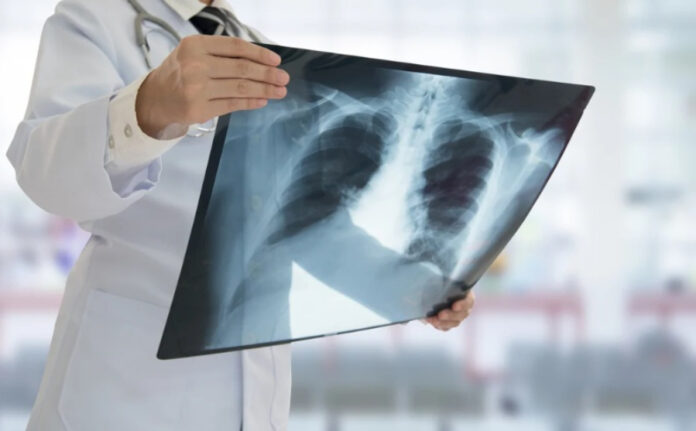 Radiologistas_greve_AM